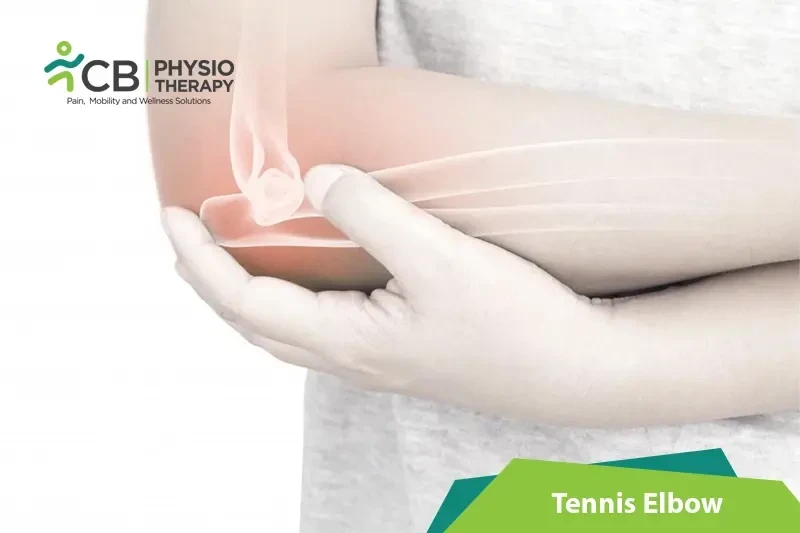 Top 5 Exercises For Tennis Elbow