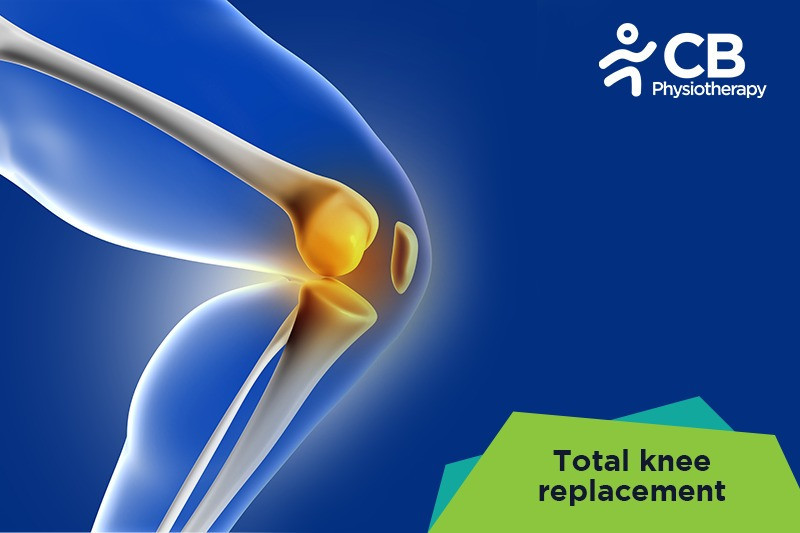Top 5 Exercises For Total Knee Replacement(tkr)