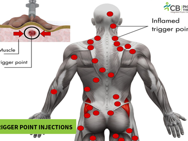 - CB Physiotherapy